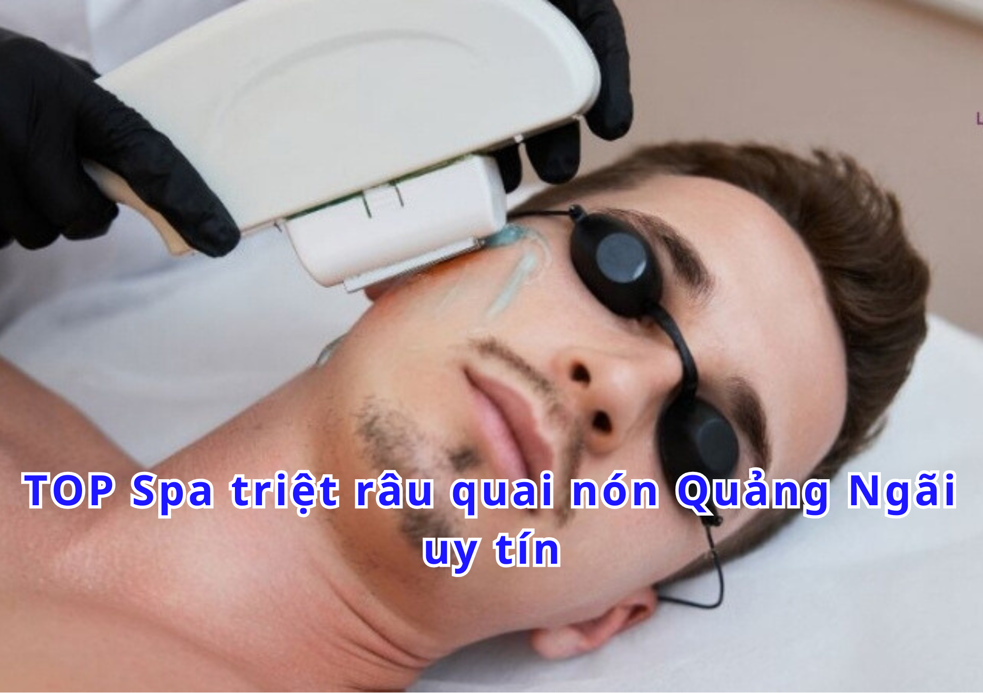 Spa triệt râu quai nón Quảng Ngãi Uy tín