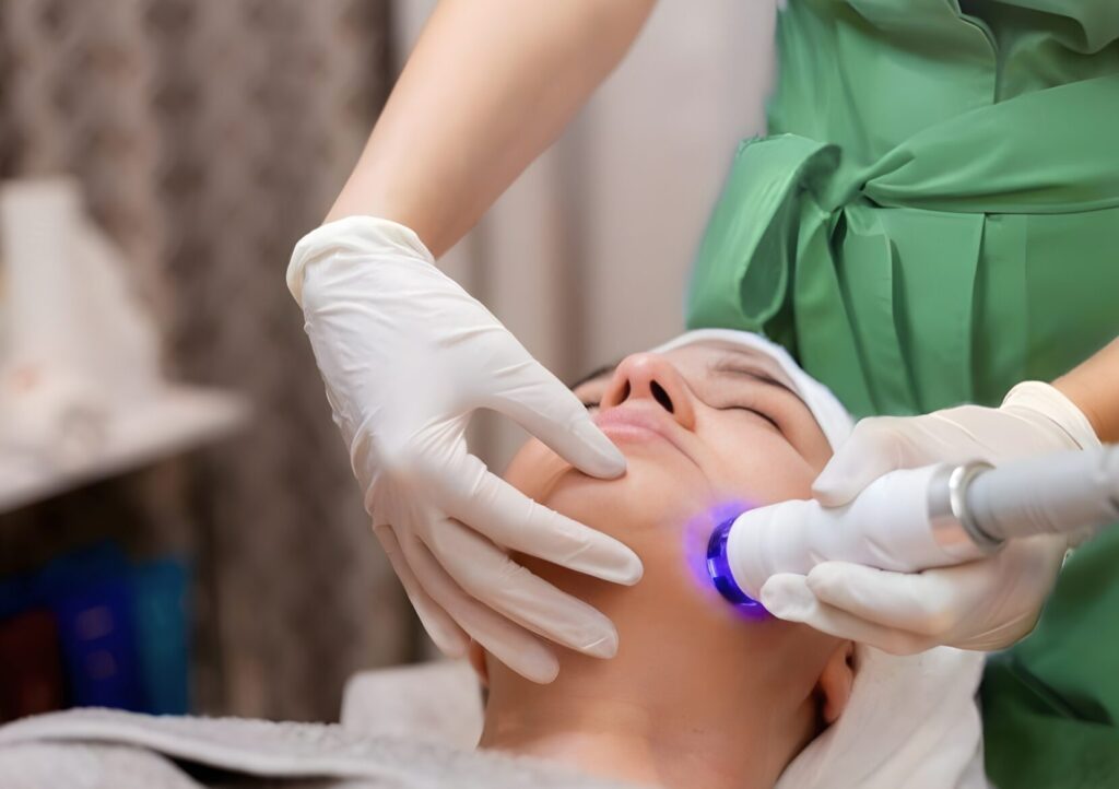 SkinSmart Campus Spa - Triệt ria mép Quảng Ngãi uy tín