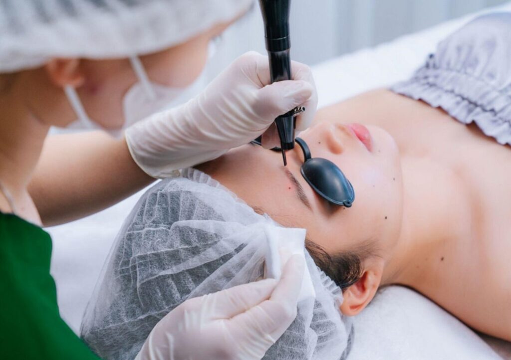 SkinSmart Campus Spa - Xoá nốt ruồi Quảng Ngãi uy tín